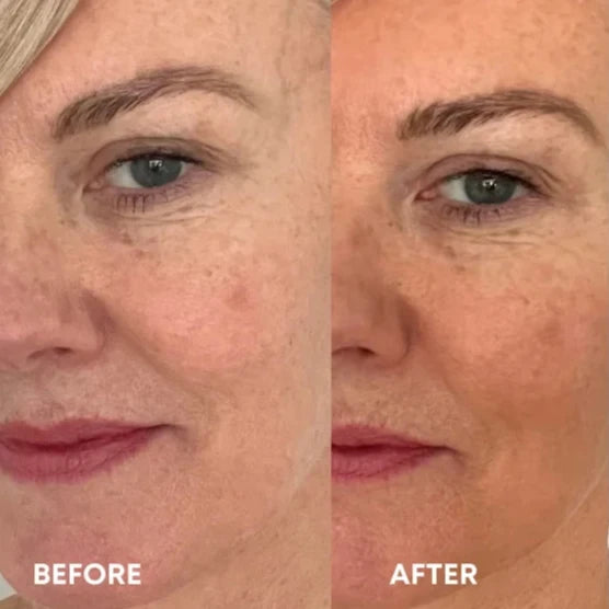 Vita Liberata - The Serum - Anti Age Face Tan 15 ml.