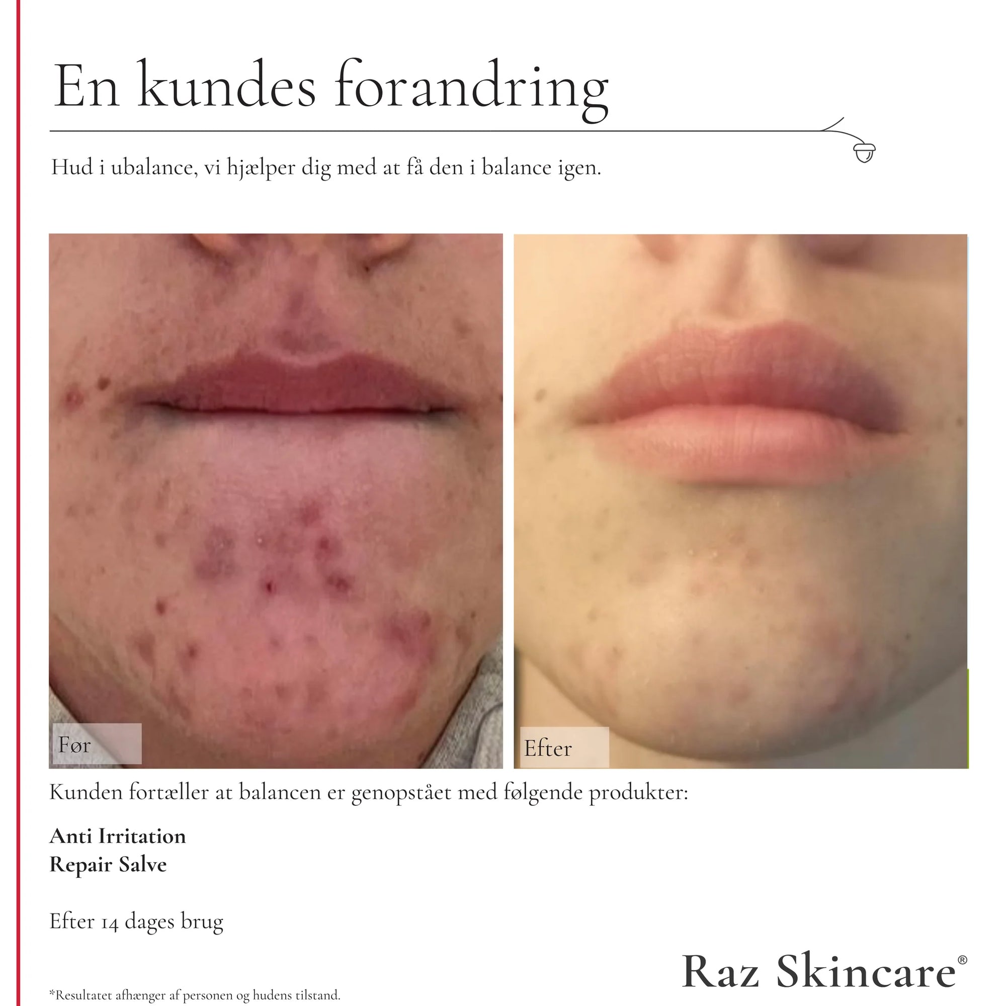 Raz Skincare - Repair Salve Parfume fri - 100 ml