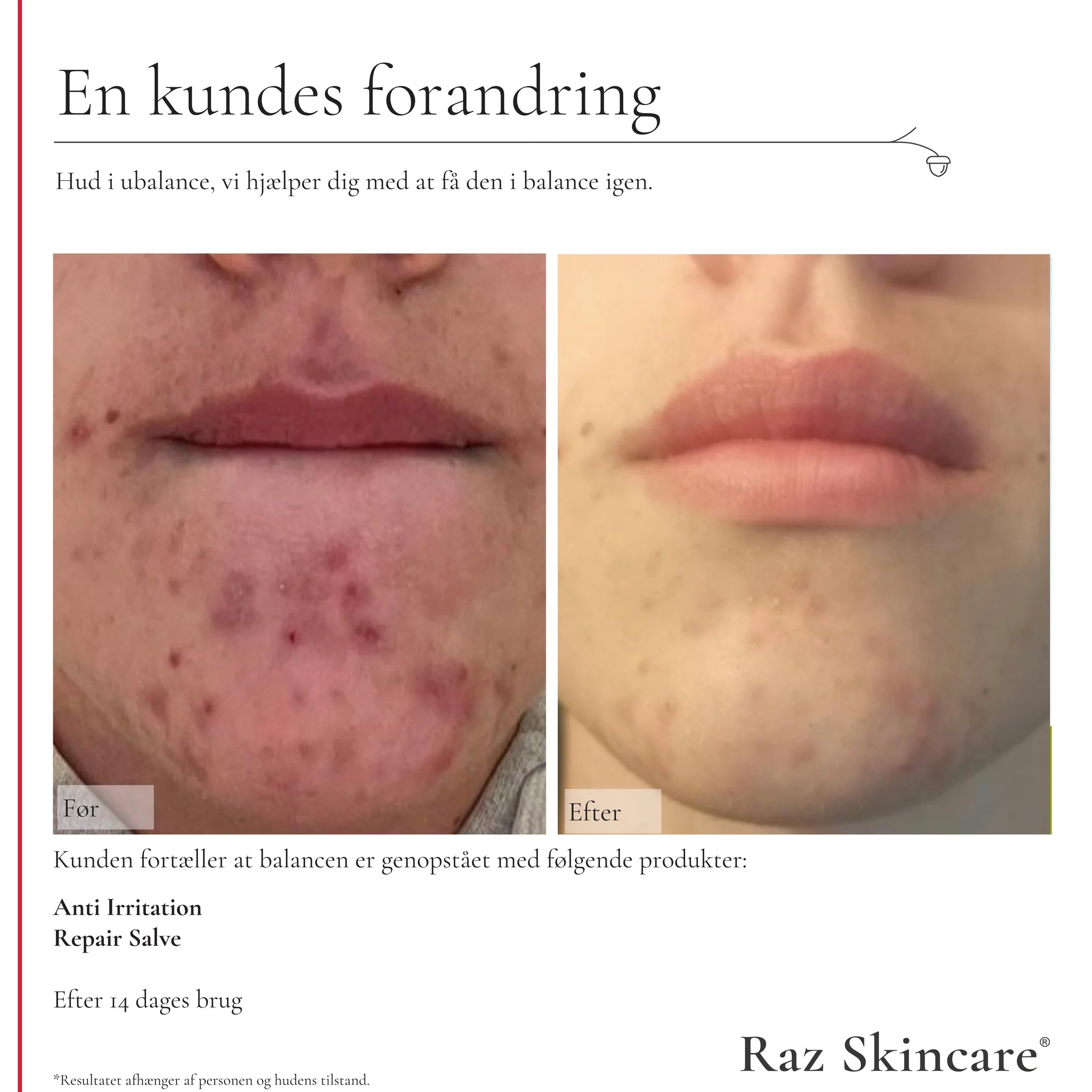 Raz Skincare - Repair Salve Parfume fri - 100 ml