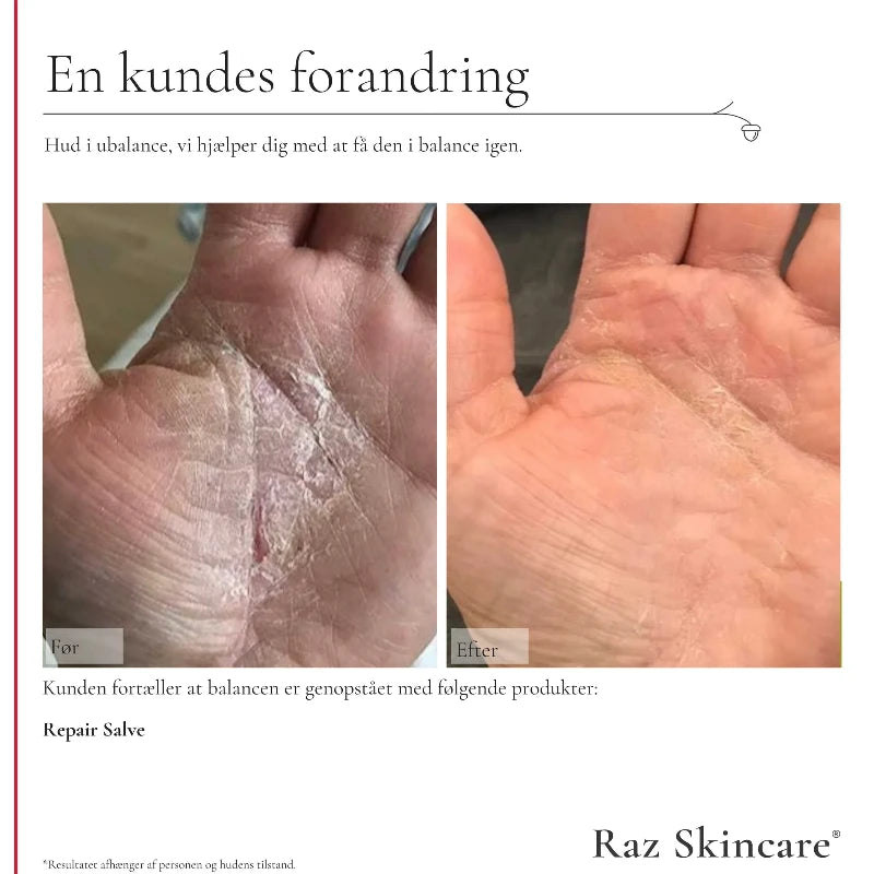 Raz Skincare - Repair Salve Parfume fri - 100 ml