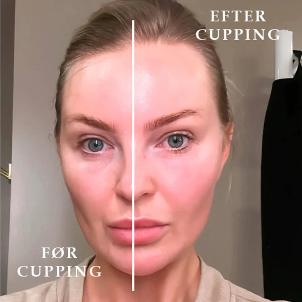 Natalie Maria Scandinavian - Det ultimative cupping kit