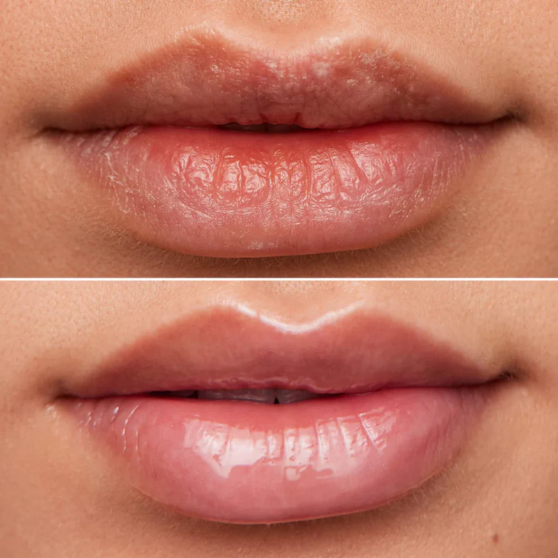 Wonderskin - Lip Rehab - Therapy Oil